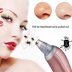 1 pcs Blackhead Removal Electric Facial Pore Cleaner Acne Remover Utilizes Pore Vacuum Extraction Skin Facial skin care tool