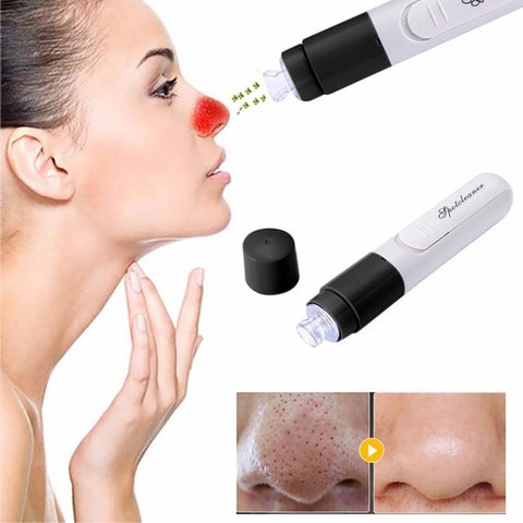 2018 Handheld Electric Blemish Blackhead Remover Cleaner Vacuum Suction Facial Blackhead Removal Skin Care Cleansing Tool Gift